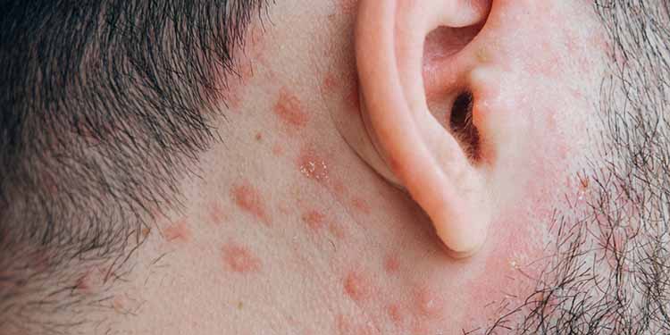 Historische Krankheiten